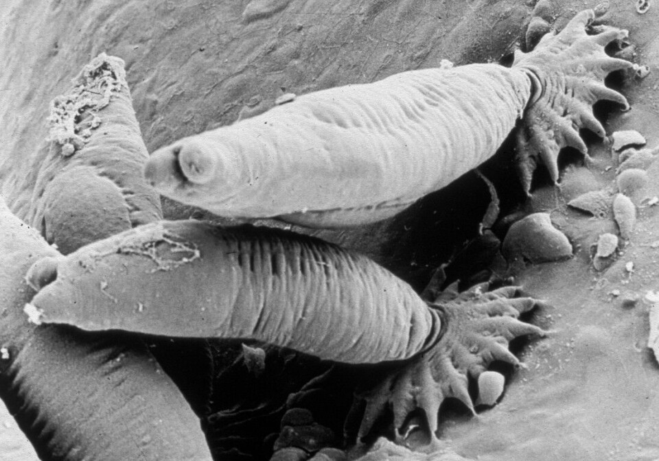 Lakseparasitten Gyrodactylus salaris har tatt livet av millioner av lakseunger i norske lakseelver de siste 40 årene. Den fargeløse parasitten er på størrelse med et punktum og kan kun ses i mikroskop. Den ødelegger lakseungens hud og væskebalanse, og dødsprosessen tar lang tid. Lakseparasitten Gyrodactylus salaris har tatt livet av millioner av lakseunger i norske lakseelver de siste 40 årene. Den fargeløse parasitten er på størrelse med et punktum og kan kun ses i mikroskop. Den ødelegger lakseungens hud og væskebalanse, og dødsprosessen tar lang tid.